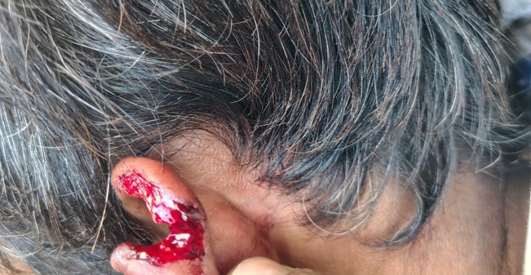 पुरानी रंजिश में लकड़ी से हमला, आरोपी गिरफ्तार।